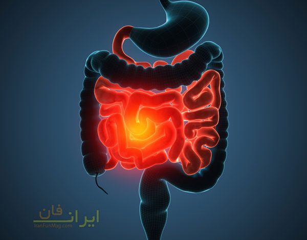 اگر دچار التهاب روده هستید این درمان های خانگی را امتحان کنید