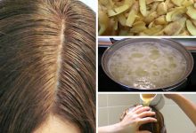 آب سیب زمینی برای موهایتان معجزه میکند