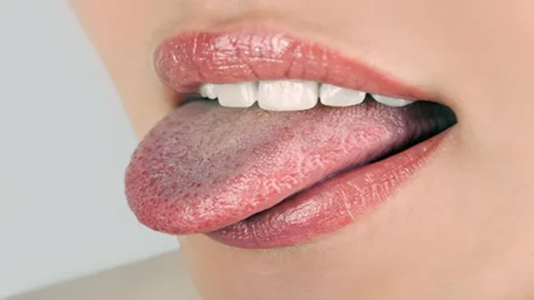 سرطان زبان: علل، علائم و روش‌های درمانی جدید