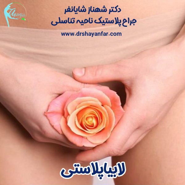 لابیاپلاستی